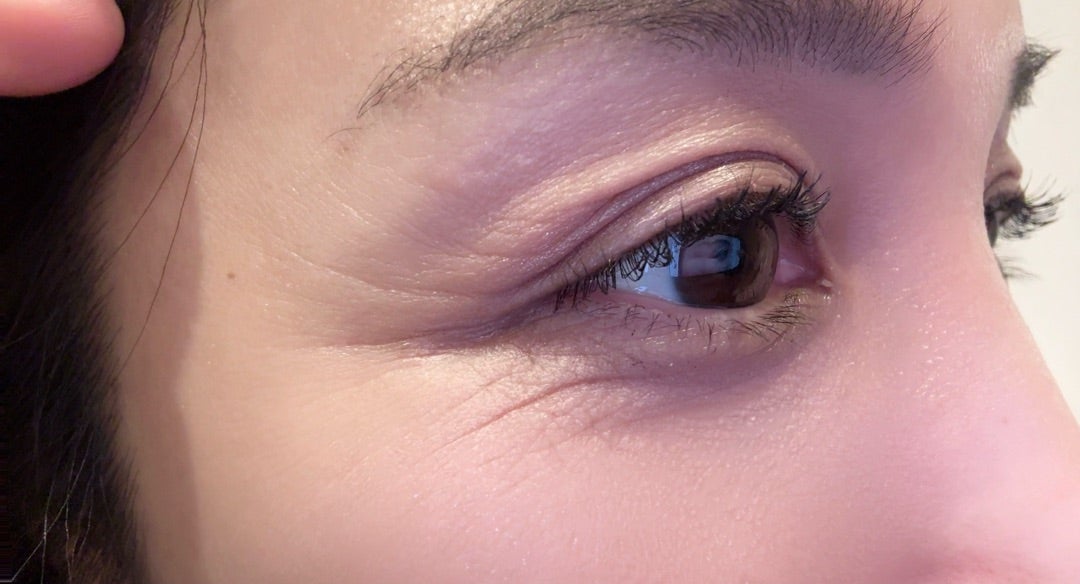 メディプラスゲルで小じわ改善