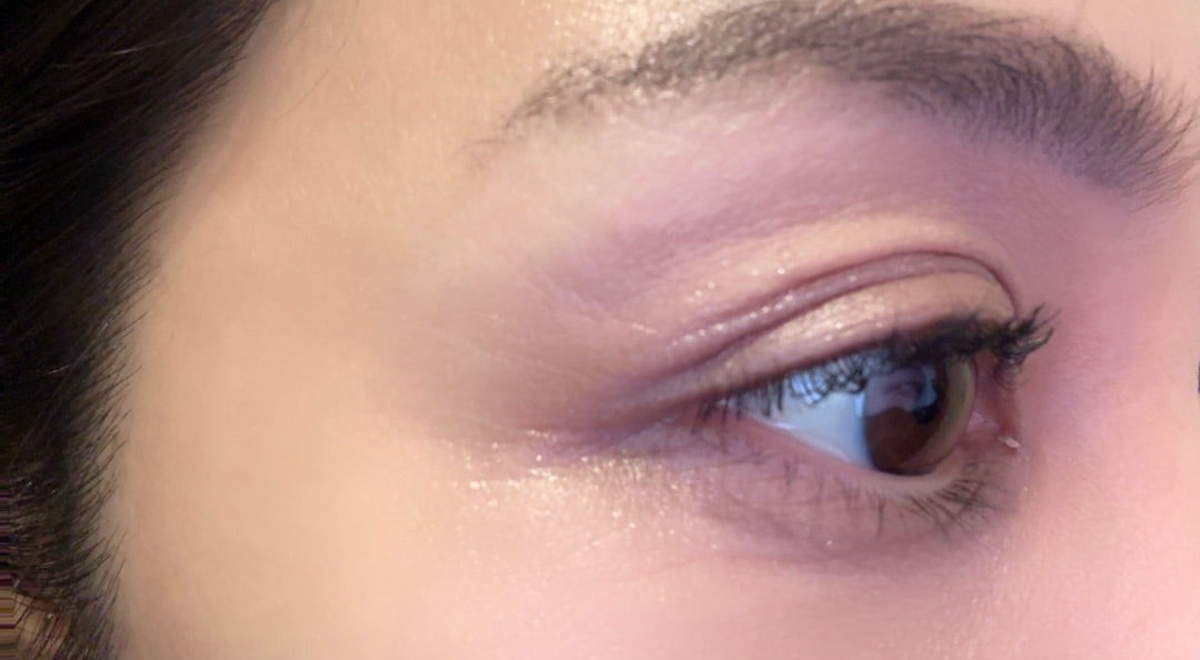 メディプラスゲルで目元小じわ解消